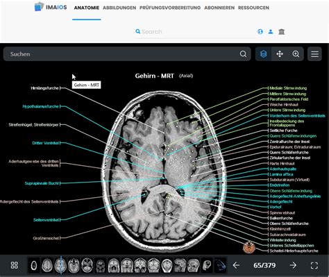 imiaos|imaios anatomy courses.